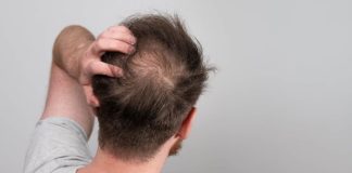 Desoxyribose bei Haarausfall